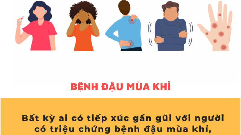 dấu hiệu bệnh đậu mùa khỉ