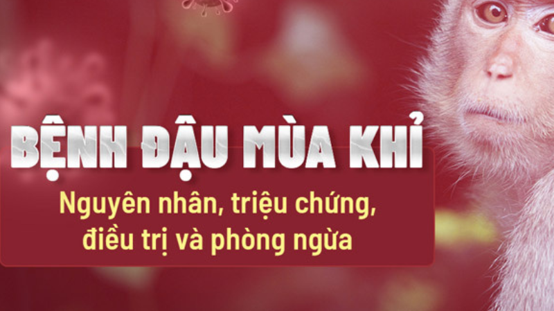 triệu chứng bệnh đậu mùa khỉ