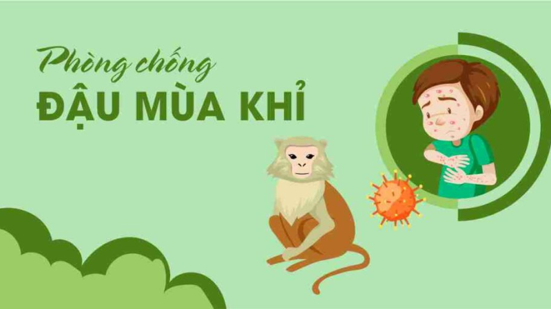 bệnh đậu mùa khỉ có nguy hiểm không