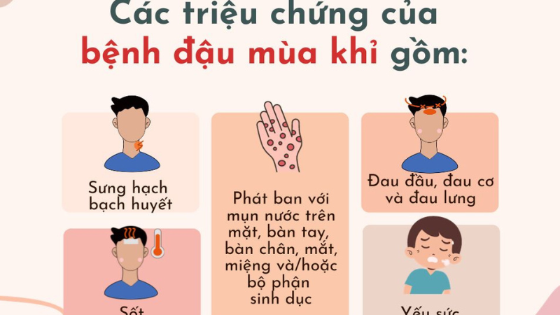 bệnh đậu mùa khỉ có nguy hiểm không